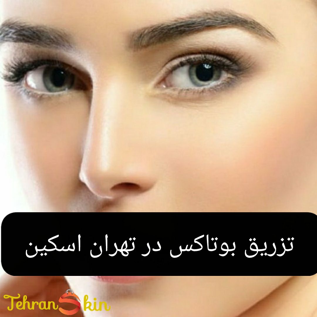 صورت صاف با تزریق بوتاکس