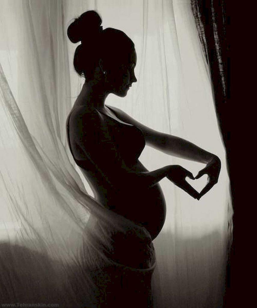 آتلیه خوب بارداری در تهران