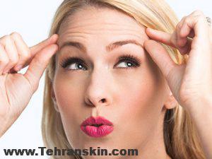 Know Your Wrinkles The Difference Between Dynamic And Static 1022x522 1 300x225 - رفع چین و چروک صورت با بوتاکس | هزینه بوتاکس صورت