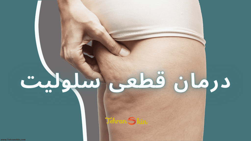 از بین بردن سلولیت با مزوتراپی