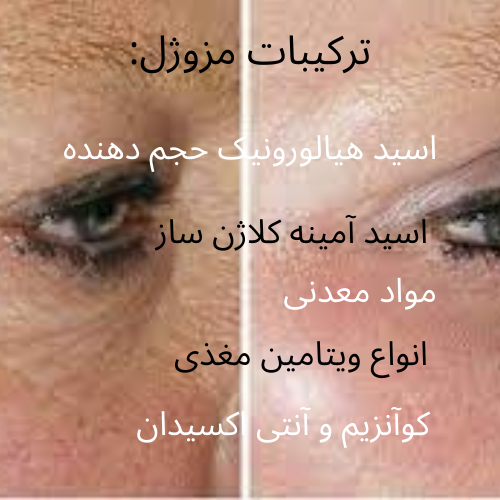 %D8%AA%D9%81%D8%A7%D9%88%D8%AA %D9%85%D8%B2%D9%88%DA%98%D9%84 %D9%88 %D8%AA%D8%B2%D8%B1%DB%8C%D9%82 %DA%98%D9%84 - تزریق حرفه ای مزوژل جالپرو و انواع مزوتراپی در مرکز شریعتی