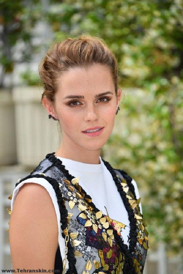 Emma Watson no full lips - بهترین مرکز تزریق ژل لب تهران: دلایل علاقه مردان به لب؛ زیباترین مدل های لب