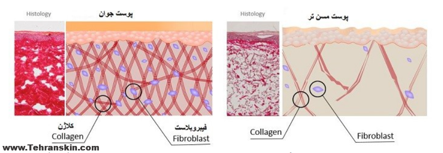 fibroblasts in mesotherapt Jalupro - تزریق حرفه ای مزوژل جالپرو و انواع مزوتراپی در مرکز شریعتی