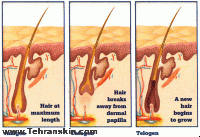سوالات متداول لیزر موهای زائد: مشاهده ی 17 تا از مهمترین نکات لیزر hairfollicle growth after laser hair removal - سوالات متداول لیزر موهای زائد: مشاهده ی 17 تا از مهمترین نکات لیزر