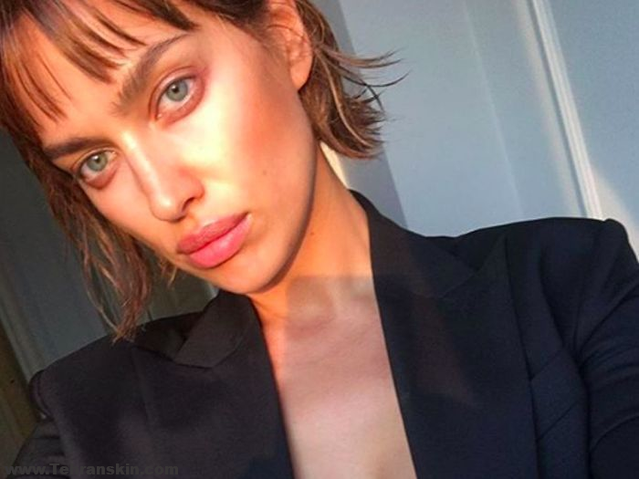 بهترین مرکز تزریق ژل لب تهران