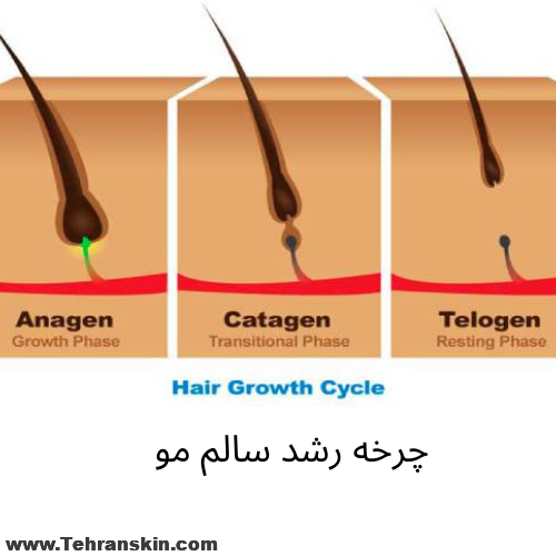 علت اصلی برگشت پذیری موهای زائد
