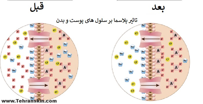 %D8%AA%D8%A7%D8%AB%DB%8C%D8%B1 %D8%A7%D9%86%D8%B1%DA%98%DB%8C %D9%BE%D9%84%D8%A7%D8%B3%D9%85%D8%A7 %D8%AC%D8%AA %D8%A8%D8%B1 %D9%BE%D9%88%D8%B3%D8%AA - 8 نکته بی پرده درباره بهترین تخفیف پلاسما جت بینی و بلفاروپلاستی