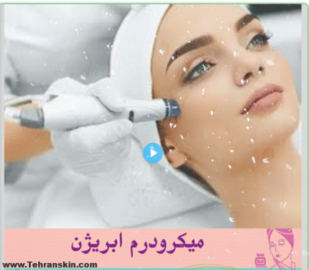 مزوتراپی بهتره یا میکرودرم