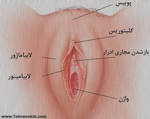 تزریق چربی به لابیا و پوبیس برای تقویت شادابی جنسی در رابطه زناشویی %D8%B4%DA%A9%D9%84 %D9%84%D8%A7%D8%A8%DB%8C%D8%A7 %D9%88 %D9%88%D8%A7%DA%98%D9%86 %D9%88 %D9%82%D8%B3%D9%85%D8%AA %D9%87%D8%A7%DB%8C %D9%85%D8%AE%D8%AA%D9%84%D9%81 %D9%88%D8%A7%DA%98%D9%86 - تزریق چربی به لابیا و پوبیس برای تقویت شادابی جنسی در رابطه زناشویی