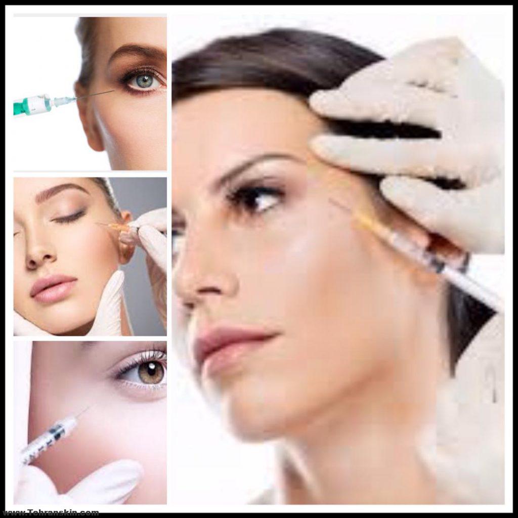 مزوتراپی دور چشم