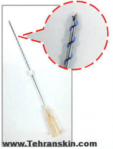 نخ پیچ دار برای لیفت صورت
