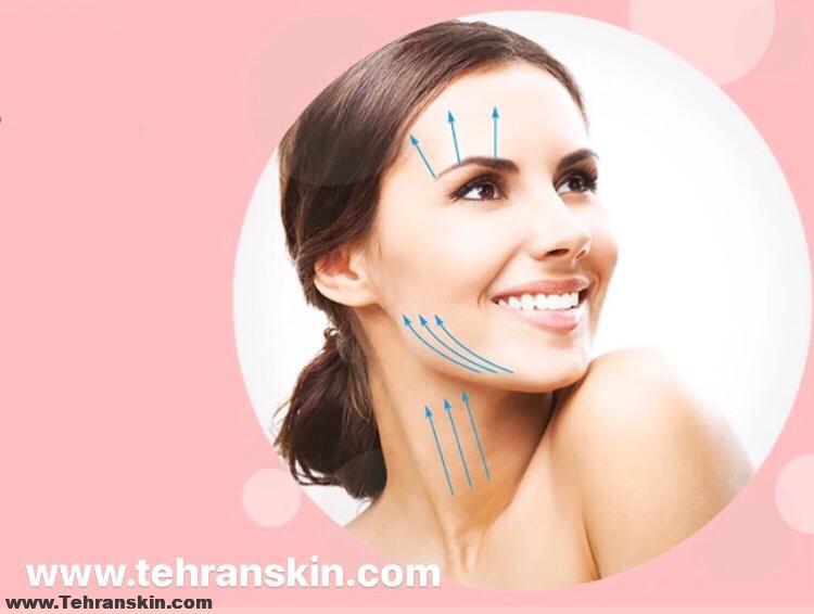 لیفت صورت با نخ