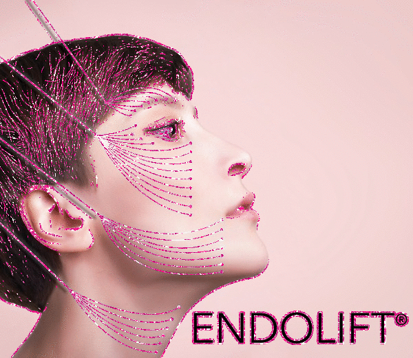 best face endolift doctor Tehran - از صفر تا صد اندولیفت صورت: بهترین متخصص اندولیفت تهران+فیلم، عکس