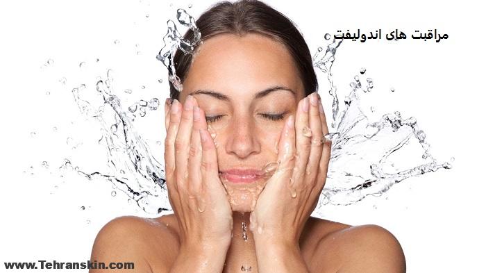 endolift before after cares - از صفر تا صد اندولیفت صورت: بهترین متخصص اندولیفت تهران+فیلم، عکس