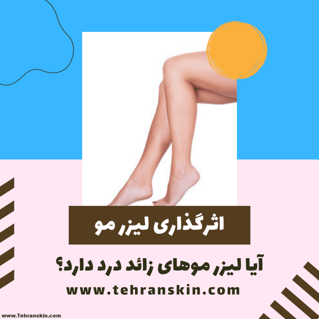 لیزر موهای زائد چقدر موثر است