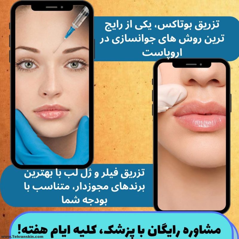 نت برگ بوتاکس تهران