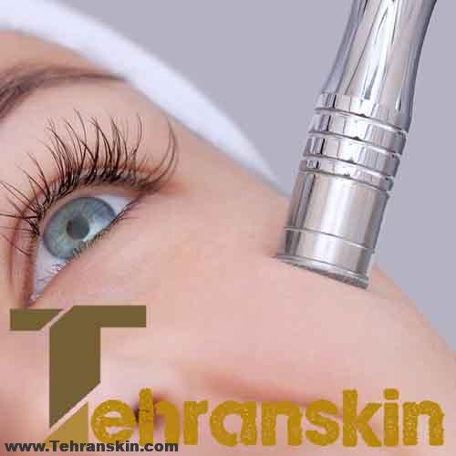 مراحل فیشیال صورت