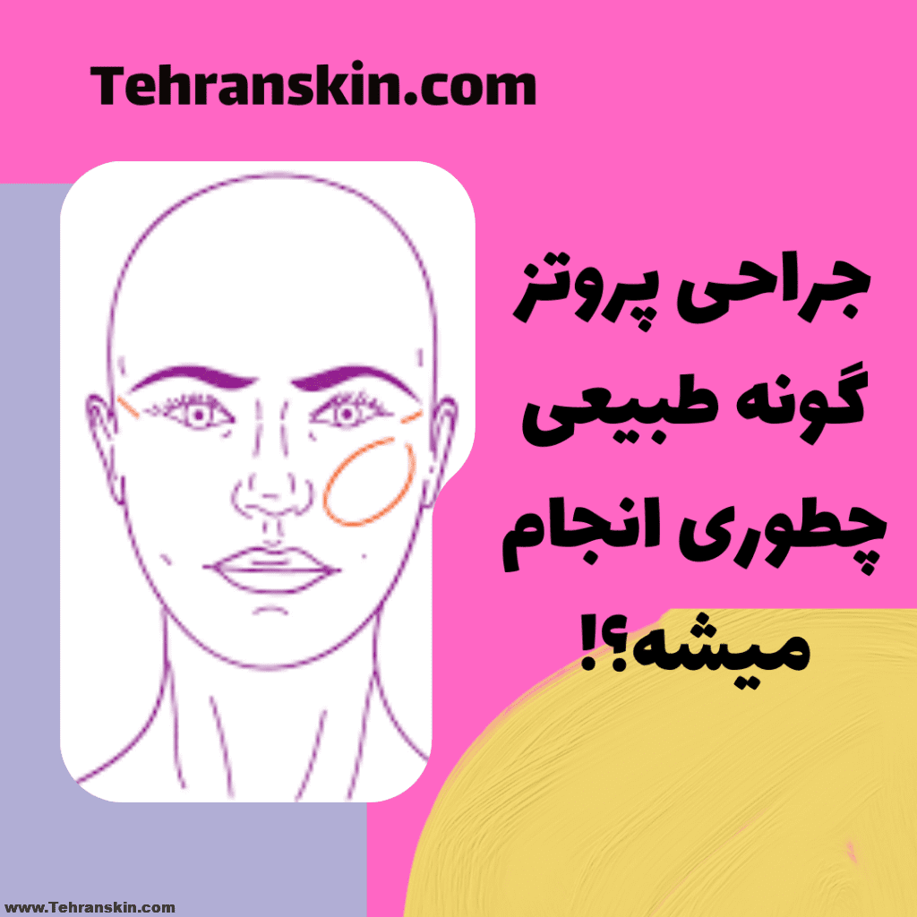 بهترین نکاتی که در مورد پروتز گونه طبیعی میتونین بخونین! %D8%A8%D8%B1%D8%AA%D8%B1%DB%8C%D9%86 %D8%AF%D9%88%D8%B1%D9%87 %D9%87%D8%A7%DB%8C %D8%A2%D9%85%D9%88%D8%B2%D8%B4 %D8%A2%D9%86%D9%84%D8%A7%DB%8C%D9%86 2022 05 24T005107.031 1024x1024 - بهترین نکاتی که در مورد پروتز گونه طبیعی میتونین بخونین!