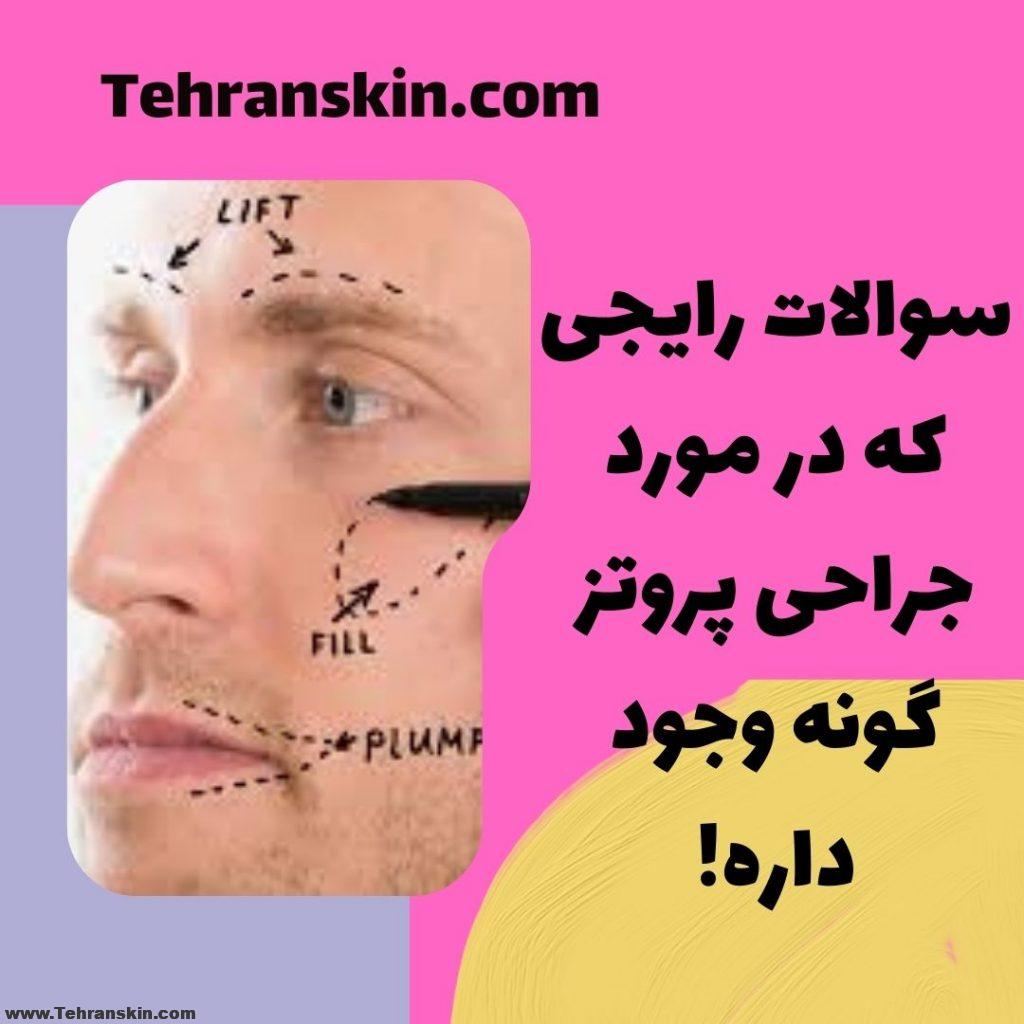 بهترین نکاتی که در مورد پروتز گونه طبیعی میتونین بخونین! %D8%A8%D8%B1%D8%AA%D8%B1%DB%8C%D9%86 %D8%AF%D9%88%D8%B1%D9%87 %D9%87%D8%A7%DB%8C %D8%A2%D9%85%D9%88%D8%B2%D8%B4 %D8%A2%D9%86%D9%84%D8%A7%DB%8C%D9%86 39 1024x1024 - بهترین نکاتی که در مورد پروتز گونه طبیعی میتونین بخونین!