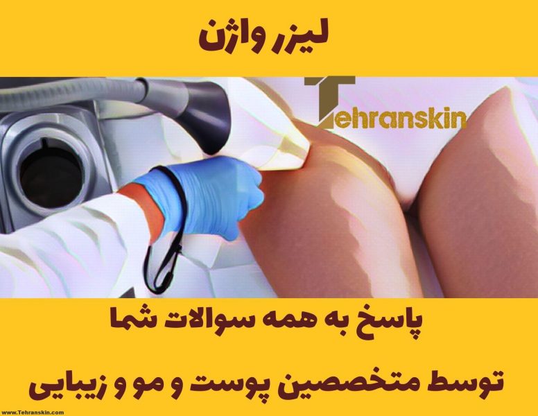 لیزر موهای واژن