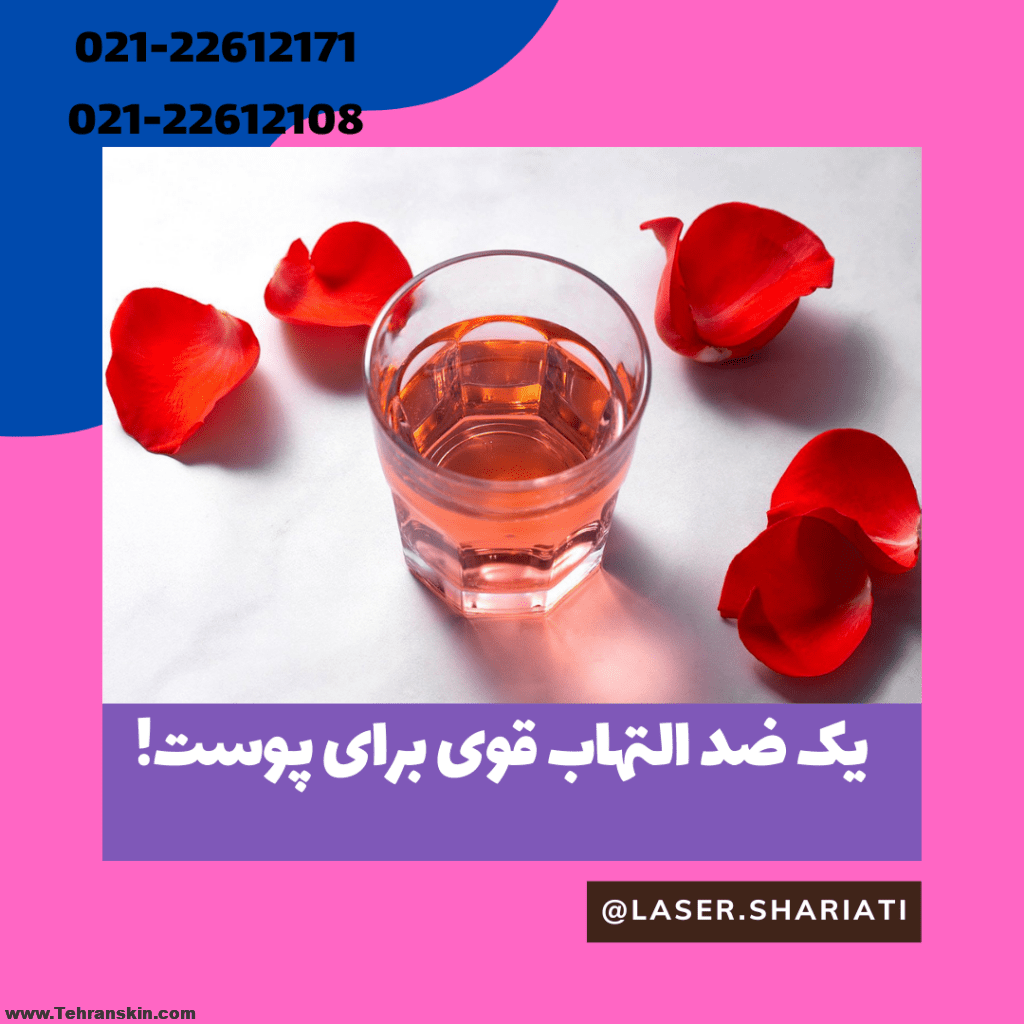 فواید گلاب برای پوست