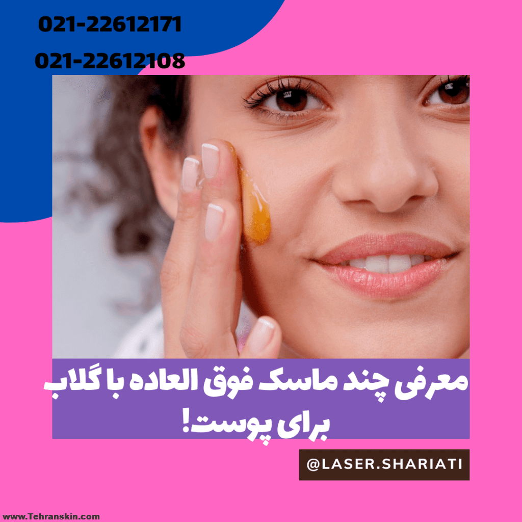 فواید گلاب برای پوست