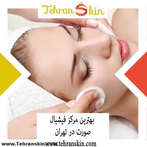 %D8%A7%D9%82%D9%81%D8%A7%D9%82%D8%A7 - هزینه فیشیال صورت در بهترین مرکز زیبایی چقدر است؟