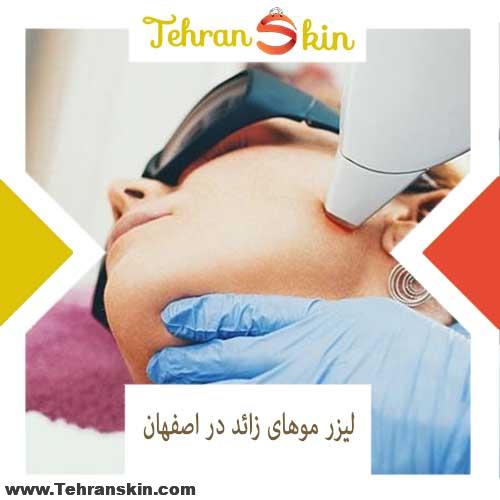 %D8%A8%D9%81%D8%A7%D9%81%D9%82%D8%A8%D8%A7%D9%82 - بهترین مرکز لیزر موهای زائد در اصفهان کجاست؟