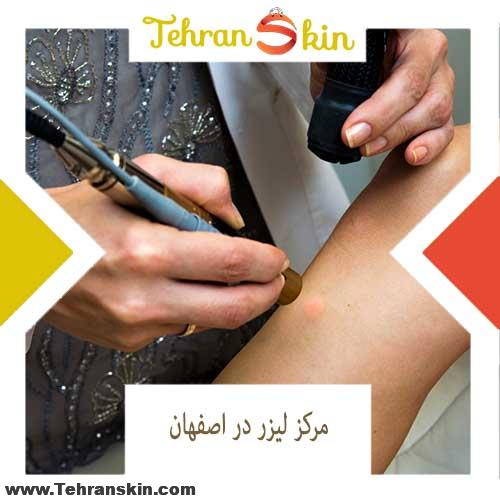 %D8%BA%D9%85%D9%86%D8%B9%D8%BA%D9%85%D9%81%D8%BA%D9%87 - بهترین مرکز لیزر موهای زائد در اصفهان کجاست؟